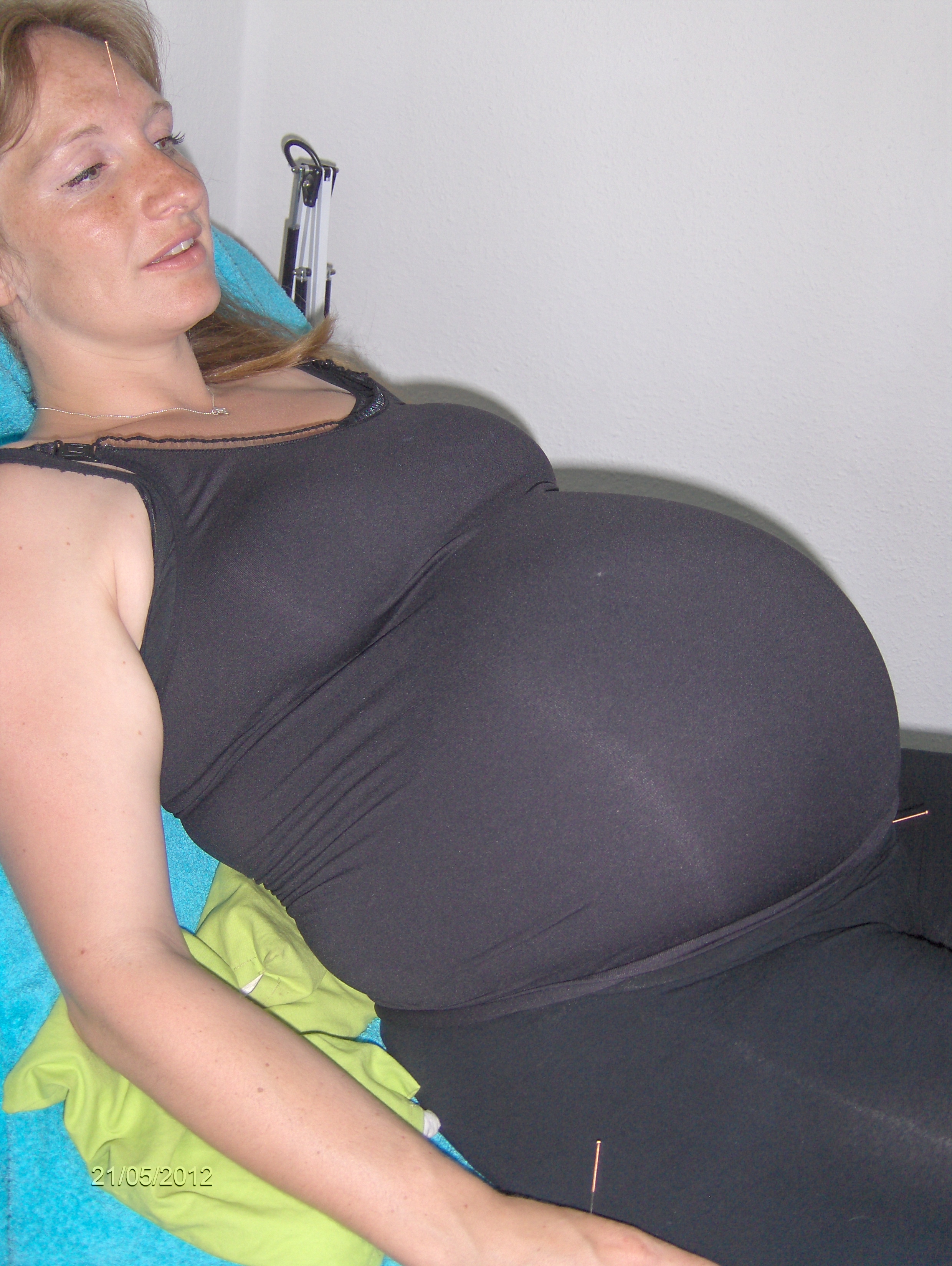 Akupunktur til gravide, fx. modning til fødsel